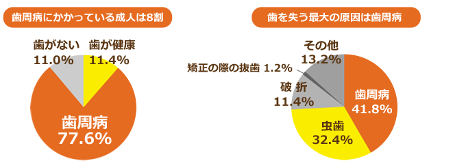 しらゆり歯科医院の歯周病治療