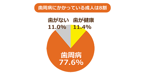 しらゆり歯科医院の歯周病治療