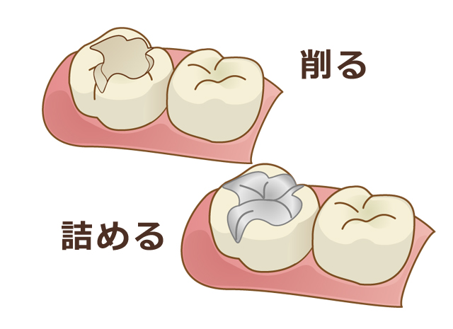 しらゆり歯科医院の予防歯科