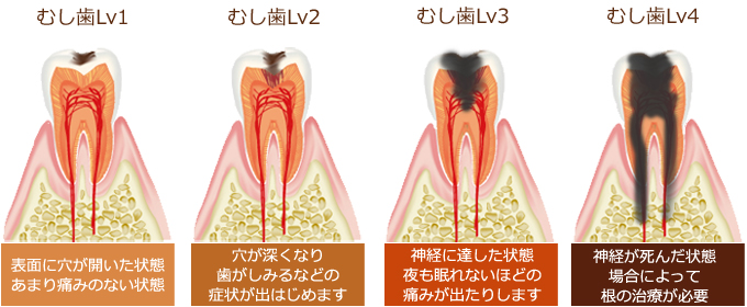 しらゆり歯科医院の予防歯科