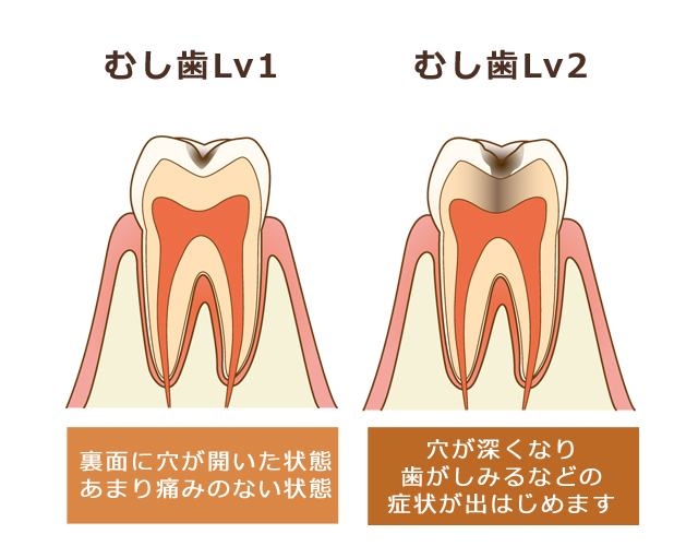 しらゆり歯科医院の予防歯科