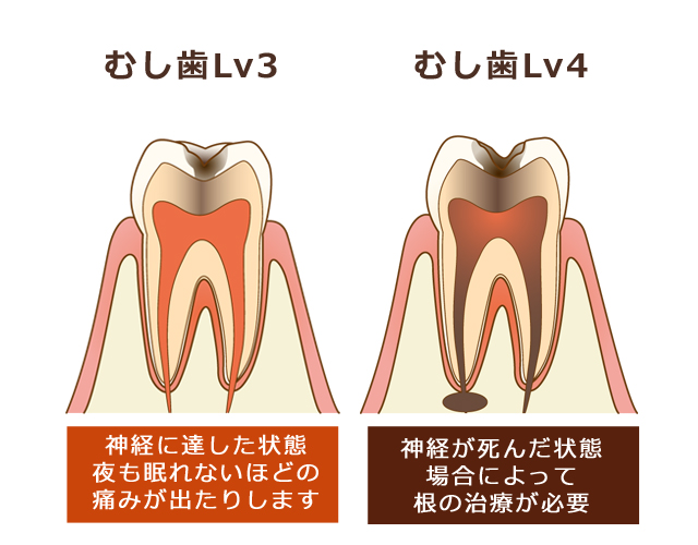 しらゆり歯科医院の予防歯科