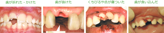 しらゆり歯科医院の歯科口腔外科・こんな時はすぐにご連絡ください