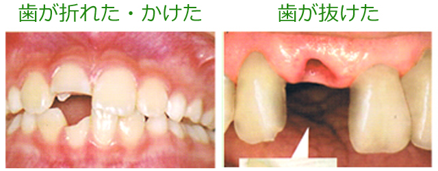 しらゆり歯科医院の歯科口腔外科・こんな時はすぐにご連絡ください